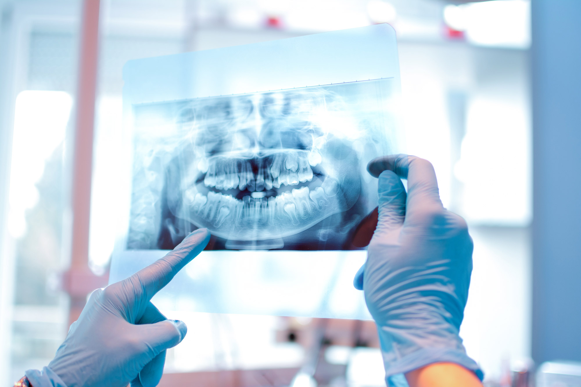  Achi_Zahnarzt_Stutensee_Leistungen_Endodontie_iStock-819839636.jpg